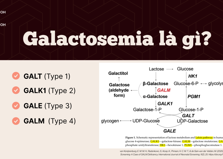 Chế độ ăn cho trẻ Galactosemia – BS Nguyễn Chơn Minh Hiếu