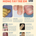 NHỮNG BIỂU HIỆN MÓNG TAY THƯỜNG GẶP Ở TRẺ EM